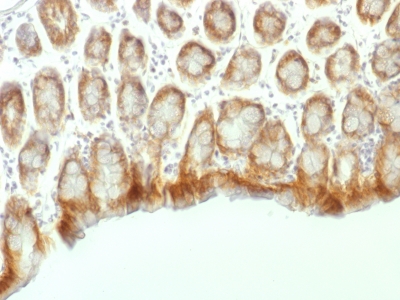 Formalin-fixed, paraffin embedded mouse colon sections stained with 100 ul anti-Beta Catenin (clone CTNNB1/1507) at 1:300. HIER epitope retrieval prior to staining was performed in 10mM Tris 1mM EDTA, pH 9.0.